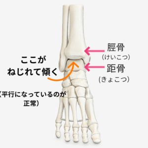 脛骨と距骨の位置関係を示した足首の図