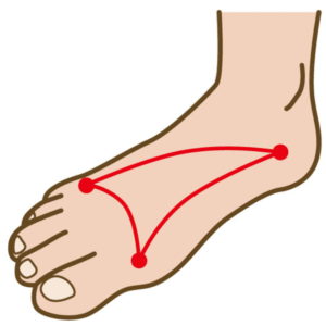 足裏アーチの仕組みを説明するイラスト。外反母趾の原因理解に使用